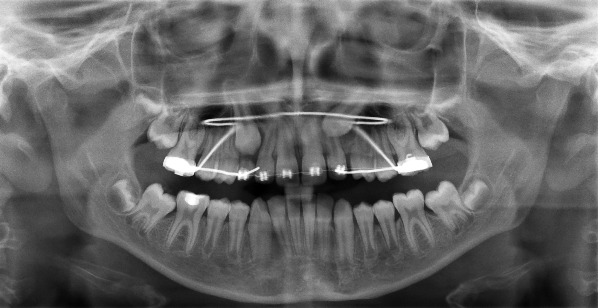 Tutto quello che devi sapere sull'ortodonzia